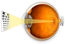 TheEyeGuys's tweet image. Hyperopia (farsightedness)
If you can see objects at a distance clearly but have trouble focusing well on objects close up, you may be farsighted. Check out our website to learn more!
#fishbaughfamilyeyecare #theyearofperfectvision #eyehealth

fishbaughfamilyeyecare.com/vision-conditi…