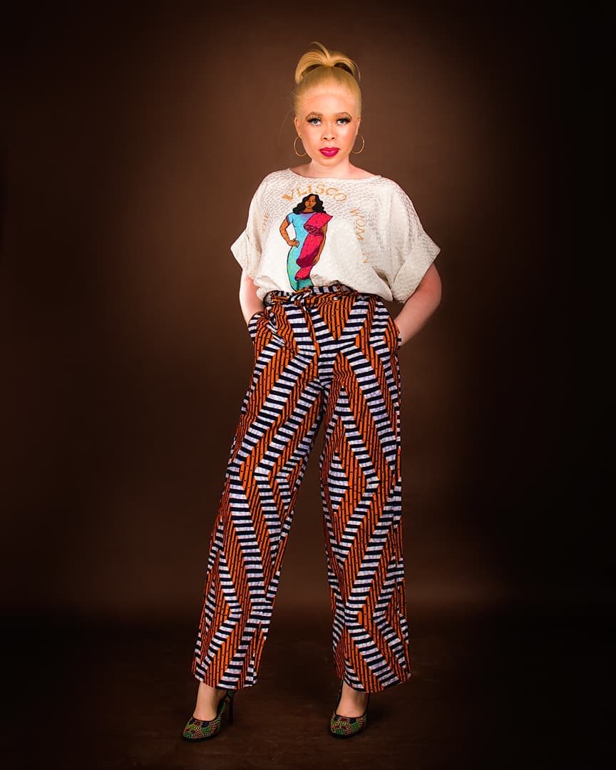 OAMFoundation's tweet photo. Melanin is the pigment that gives colour to the skin, hair, and eyes. #BeyondTheComplexion #AlbinismAwareness https://t.co/9RtqLKTfMW