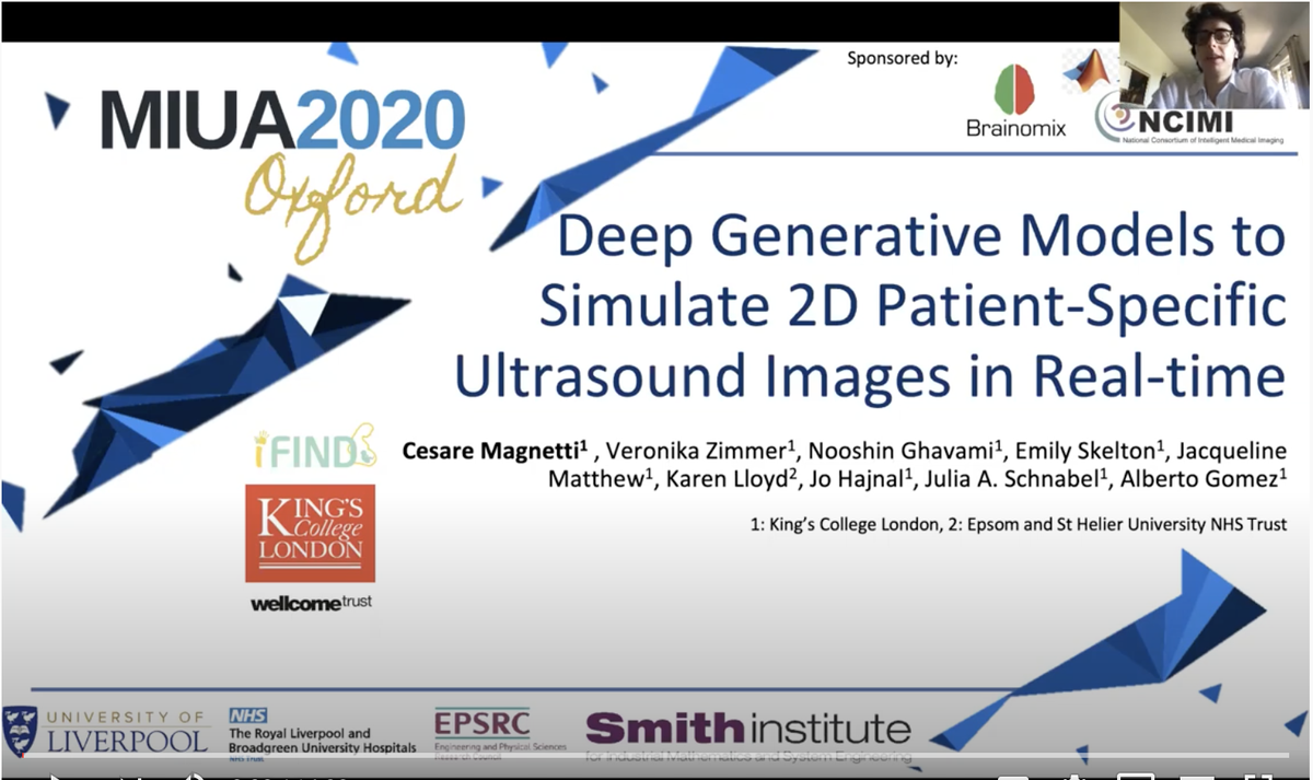 ja_schnabel's tweet photo. #MIUA2020 presentation on "Deep Generative Models to Simulate 2D Patient-Specific Ultrasound Images in Real Time" by our @KingsImaging final year undergraduate, Cesare Magnetti on https://t.co/Ea46cBSNN4 #iFIND https://t.co/CXjFoL9f31