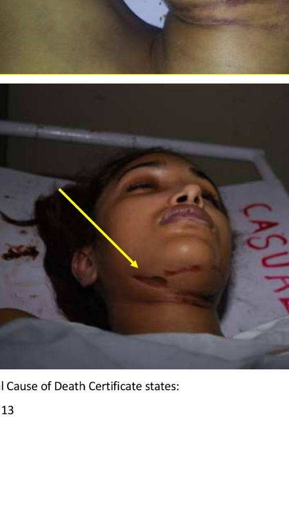 JiahKhanJustice's tweet photo. #Police & #CBI focus is on “Circumstantial evidence”, it is a very tricky thing. In #jiahkhan & #sushantsingh case, if both #CBI ##police focus on “#factualevidence”the findings & result may not be entirely suitable, uncompromisingly pointing to homicide. #complicit #homicide https://t.co/b5ghOBt2BL