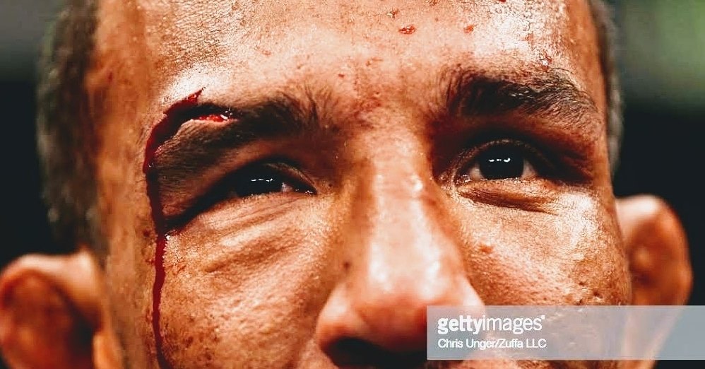 BarcelosRaoni's tweet photo. Cada cicatriz que temos é a confirmação de que uma ferida sara. Cicatrizes são marcas de superação que só um verdadeiro guerreiro possui.
Minha vontade de ser campeão só aumenta 🙌
#UFC
#UsinadeCampeões
#refitrefinaria
#refitprofighte
@ufc
@ufc_brasil https://t.co/yX3dU6nvY1