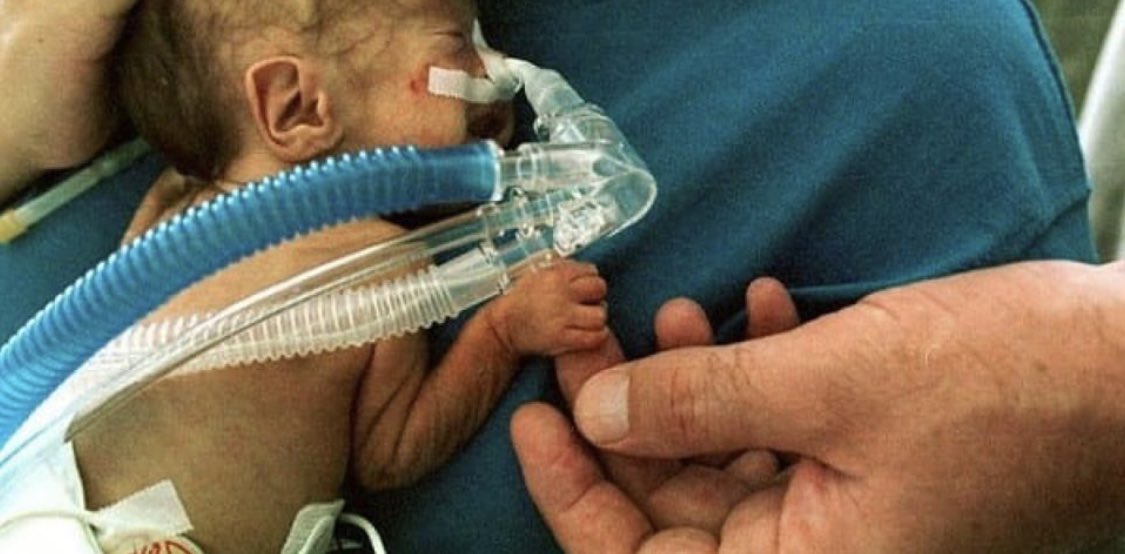NICU_Musings's tweet photo. Putting all the evidence together it would seem that azithromycin can reduce risk of BPD (RR=0.83, 95% CI 0.71 to 0.98, p=0.02).  Is your practice due for a change? https://t.co/OdNXOQv9hl https://t.co/El7x4VO5MR