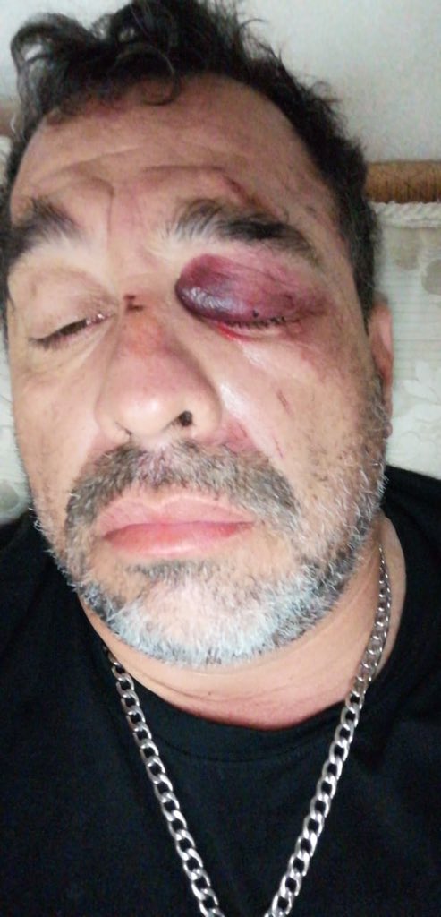 Juan Carlos Nava A. tweet media