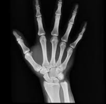 JJcolemanMD's tweet photo. This is your hand.

This is your hand on fireworks. 

#JustSayNo https://t.co/P7W2nP3vvb