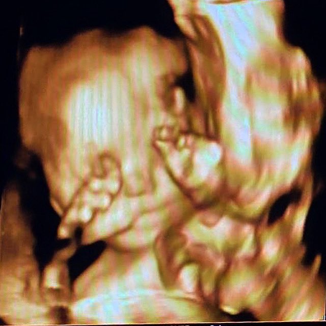 Eduardo Bolsonaro🇧🇷 tweet media