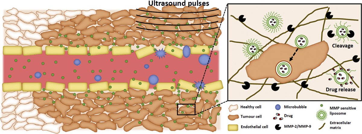 JCRnEDITORS's tweet photo. Ultrasound-mediated delivery enhances therapeutic efficacy of MMP sensitive liposomes.
| Marieke Olsman, Norwegian University of Science and Technology |
https://t.co/eOA3QwJ2tR https://t.co/crURRXrH3s