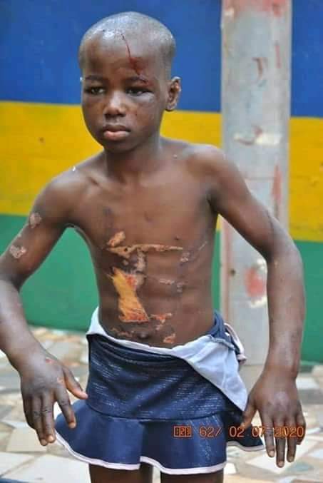 harri_onuoha's tweet image. The offense this girl committed was carrying ifeoma's little baby around 12am in the midnight &amp;amp; slept off, so the baby fell off her hands but without any physical injury. what mrs ifeoma did was to use hot iron to design her skin &amp;amp; also used big nail to puncture her head.