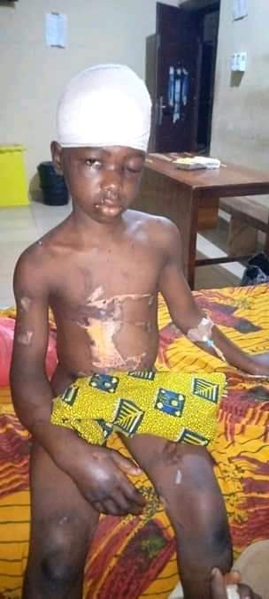 harri_onuoha's tweet image. The offense this girl committed was carrying ifeoma's little baby around 12am in the midnight &amp;amp; slept off, so the baby fell off her hands but without any physical injury. what mrs ifeoma did was to use hot iron to design her skin &amp;amp; also used big nail to puncture her head.