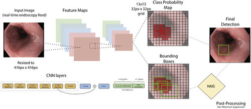 Jason Samarasena (@jasonsamarasena) on Twitter photo AI using convolutional neural networks for real-time detection of early esophageal neoplasia in Barrett’s Esophagus endoscopedia.com/2020/06/19/sam… via <a href="/GIE_Journal/">GIE</a>
Thanks! <a href="/Docbot/">Docbot</a> <a href="/AndrewNinh/">Andrew Ninh</a> <a href="/gutdoctors/">William Karnes, MD</a> <a href="/TylerAllMight/">Tyler</a> <a href="/jamesrequa/">James Requa</a> <a href="/UCIrvineHealth/">UCI Health</a>
<a href="/GIE_Journal/">GIE</a>
#ArtificialIntelligence AI using convolutional neural networks for real-time detection of early esophageal neoplasia in Barrett’s Esophagus endoscopedia.com/2020/06/19/sam… via <a href="/GIE_Journal/">GIE</a>
Thanks! <a href="/Docbot/">Docbot</a> <a href="/AndrewNinh/">Andrew Ninh</a> <a href="/gutdoctors/">William Karnes, MD</a> <a href="/TylerAllMight/">Tyler</a> <a href="/jamesrequa/">James Requa</a> <a href="/UCIrvineHealth/">UCI Health</a>
<a href="/GIE_Journal/">GIE</a>
#ArtificialIntelligence