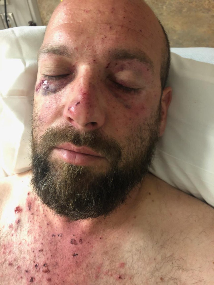 bad855cummins's tweet photo. To all my mechanic friends as a reminder for the 30 seconds you go under a truck or trailer to see what's leaking air without safety glasses on the tank can blow apart and blast metal through your eyes in a split second https://t.co/9C4wuwe9qX