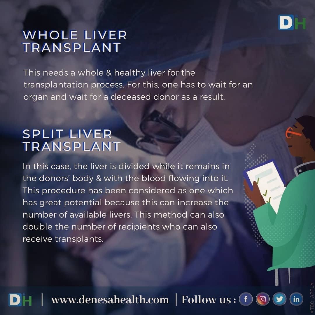 DenesaHealth's tweet photo. Types of #LiverTransplantation :
A #Liver is one of the essential parts of the body. Any issues in the function of the liver can have adverse effects on the body.  https://t.co/42Hyc0ycuq

#LiverProblems #keepingLiverhealthy #protectyourLiver #HealthyLiver #DenesaHealth #CLD https://t.co/dfcFBqSeo2