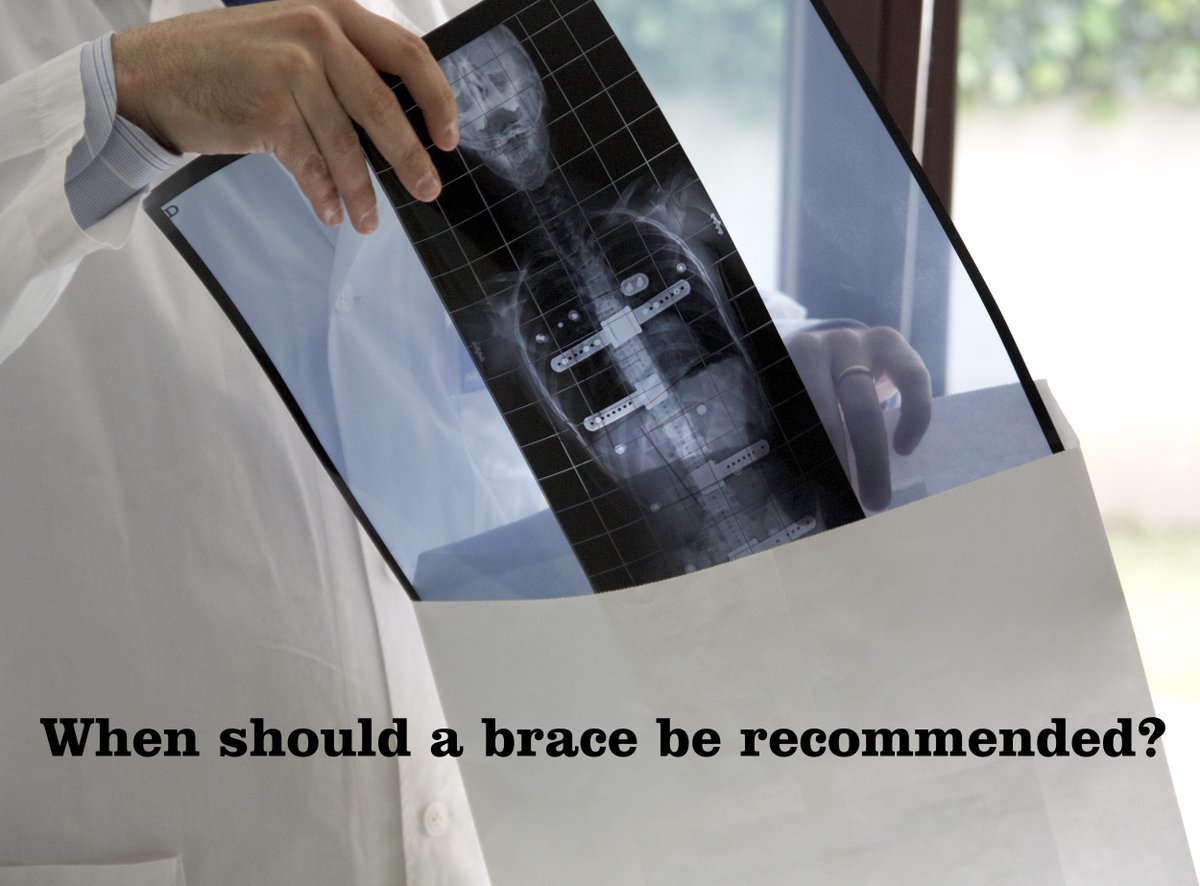 isicoitalia's tweet photo. The aim of #conservativetreatment is to ensure that patients reach bone maturity (#Risser 5) with less than 30°, or as close as possible.
#Scoliosis therapy differs according to the severity of the condition,the #CobbAngle and growth stage
👉 https://t.co/S0gIT0rrVI https://t.co/hhs5ubQU8L
