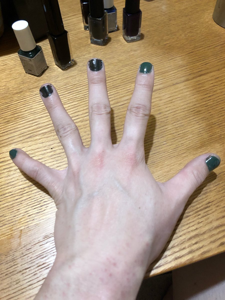 Joker On Twitter Twitterのアンケートからネイルを黒と深緑にしてみました チラッ笑 ネイル ネイルケア マニキュア ネイルポリッシュ 黒 ブラック 深緑 ダークグリーン アンケート ツイッター Nail Nailpolish Nailcare Black Darkgreen Twitter