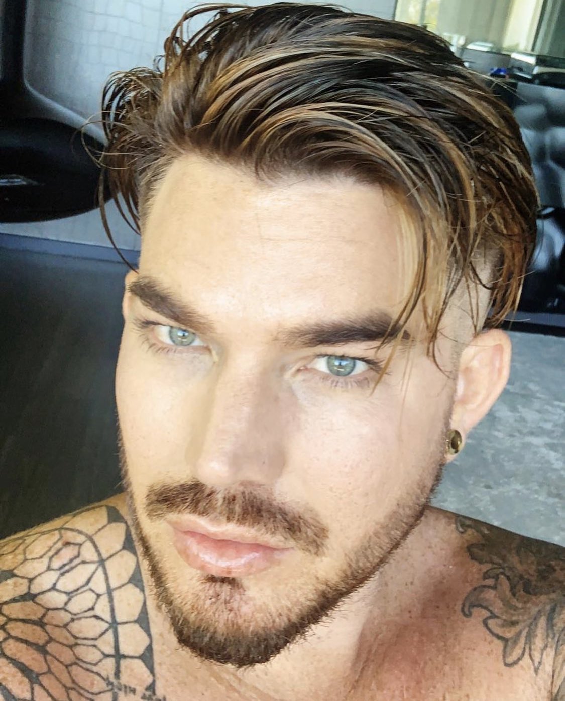 Adam Lambert Acne Scars