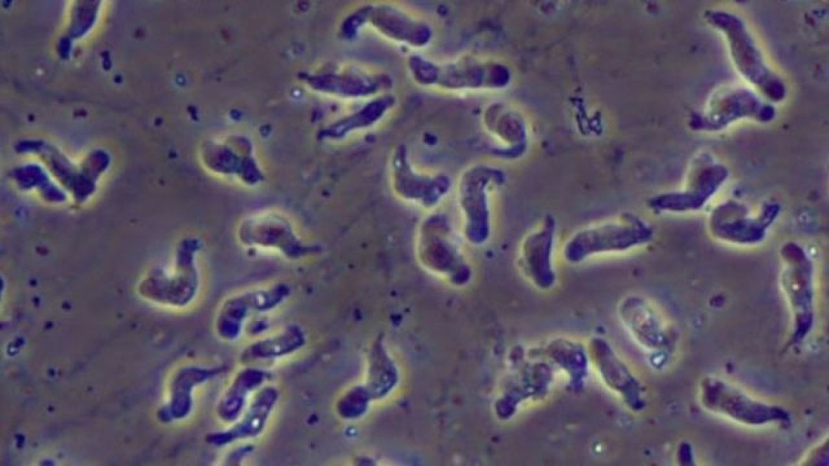 weightlossasset's tweet photo. Rare brain-eating amoeba infection reported in Florida - WITI FOX 6 Milwaukee https://t.co/cuhD8Rr2yA https://t.co/22ycnDu9xL