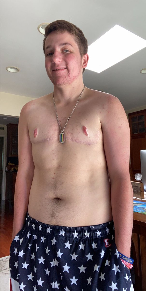 Rizzuti09's tweet photo. I just want to wish everyone a happy 4th of July. I hope you all are staying safe this holiday weekend. I’m Proud to be an Openly Gay Trans American 🇺🇸🏳️‍🌈🌈💙💛  #4thofJuly2020 #4thofJuly #LGBTQ #GayAmerican #TransAmerican #LGBTQPower #LGBTQProud #GayPride #AmericanPride #TeamPete https://t.co/3h4KQFUVEt