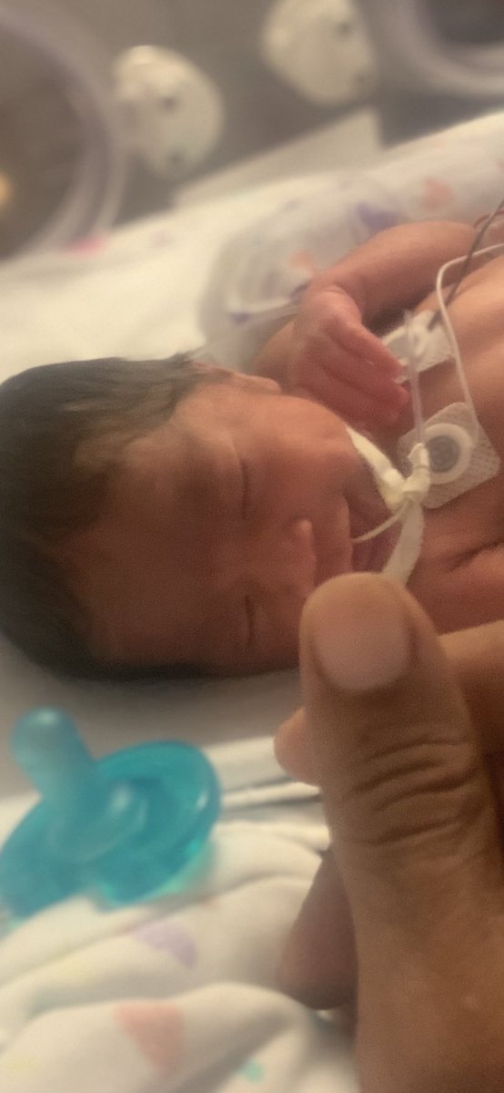 youngking_nikko's tweet photo. NIC U Update: Our daughter is now breathing in her own, and making great progress!! thank you for all the love and prayersโผ๏ธ #SayIDo #Netflix #baby4 #PrincessLyric https://t.co/6DtD994HEA
