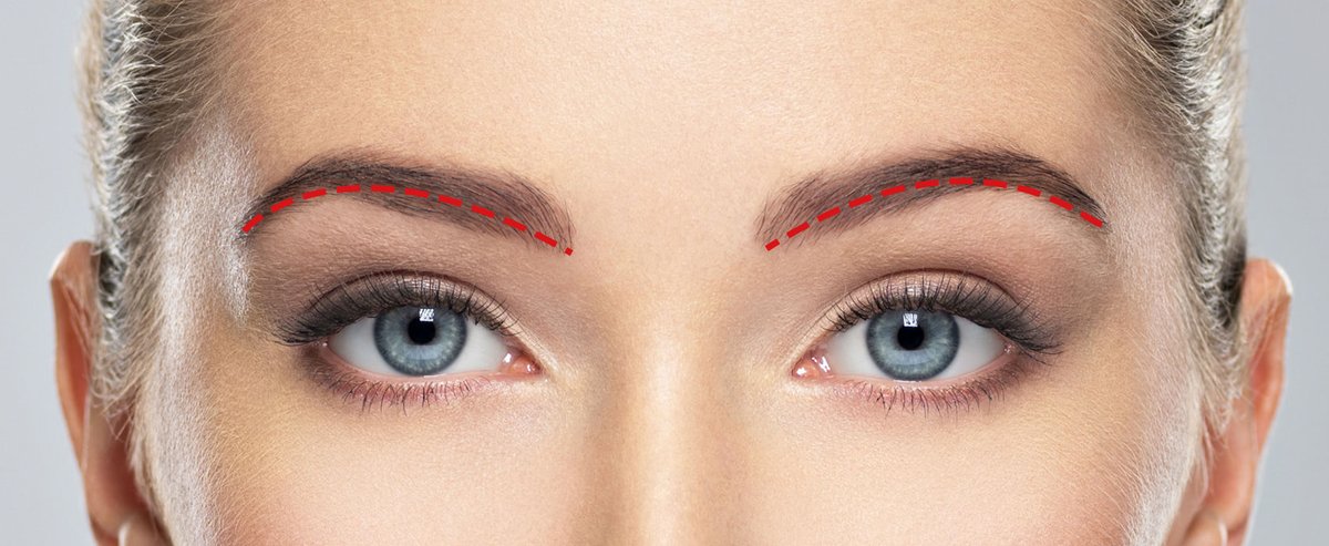 六本木境クリニック A Twitter 私が日本一埋没が上手いと思っている有名な先生 二重埋没や切らない眼瞼下垂の手術は長持ちするコスメ と言われていた もしそうであれば 取れることも納得できる でも そうであれば高い料金はnoですよね 二重埋没 二重切開 全