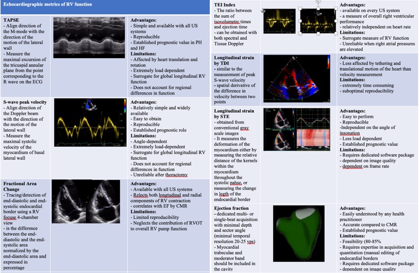 Advanced imaging of right ventricular anatomy and function  heart.bmj.com/content/early/…