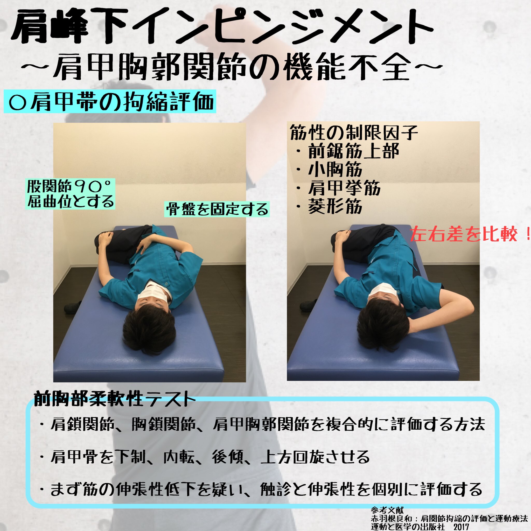 青山 幸 Pt Twitterren 肩峰下インピンジメント 肩甲胸郭関節 小胸筋の柔軟性低下 前鋸筋 僧帽筋の機能低下 中枢部 肩甲骨 の固定 による末梢 Gh 肩甲骨は制限なくどこにでも動けて 上腕に追従することが必要 青山 幸 Pt Twitterren 肩峰下インピンジメント 肩甲胸郭関節 小胸筋の柔軟性低下 前鋸筋 僧帽筋の機能低下 中枢部 肩甲骨 の固定 による末梢 Gh 肩甲骨は制限なくどこにでも動けて 上腕に追従することが必要