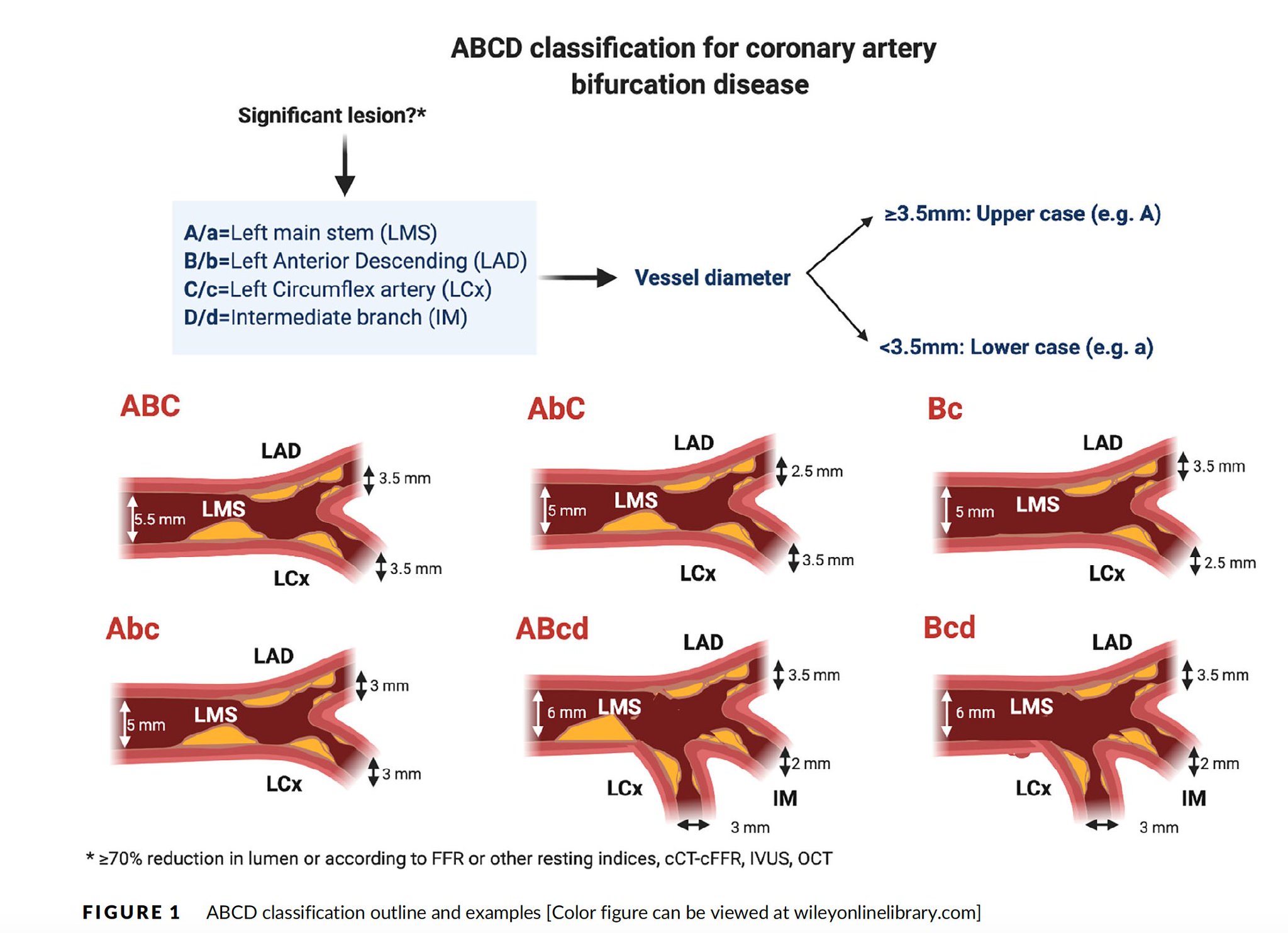 Mamas Mamas 1 New Classification For Lms Easy As Abc By Drjosefludwig1 Dr Mosama And Mmamas1973 T Co Agvg0ivdkb Why Medina Provides No Info Re Sizing Cannot Describe Trifurcations 10 Lms
