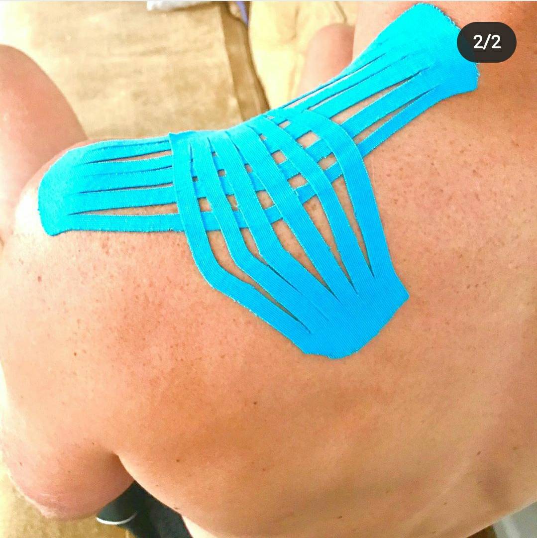 KinesioTape's tweet photo. #Repost @performancesolutionspt (@get_repost)
・・・
Love this #kinesiotaping technique for reducing soreness following #dryneedling of the upper traps. The key is very light tension. #kinesiotape #tapewithwisdom #dpt #cktp #Kinesiotapingmethod #edf https://t.co/xLg4NsClka