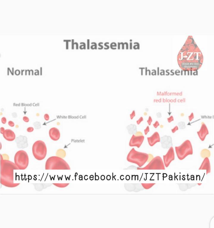 DrShoaib74's tweet photo. "If you’re a blood donor, you’re a hero to someone, somewhere, who received your gracious gift of life.”

#JehaadForZeroThalaseemia https://t.co/I48FiJrZpg https://t.co/EE3Oj5UlnK