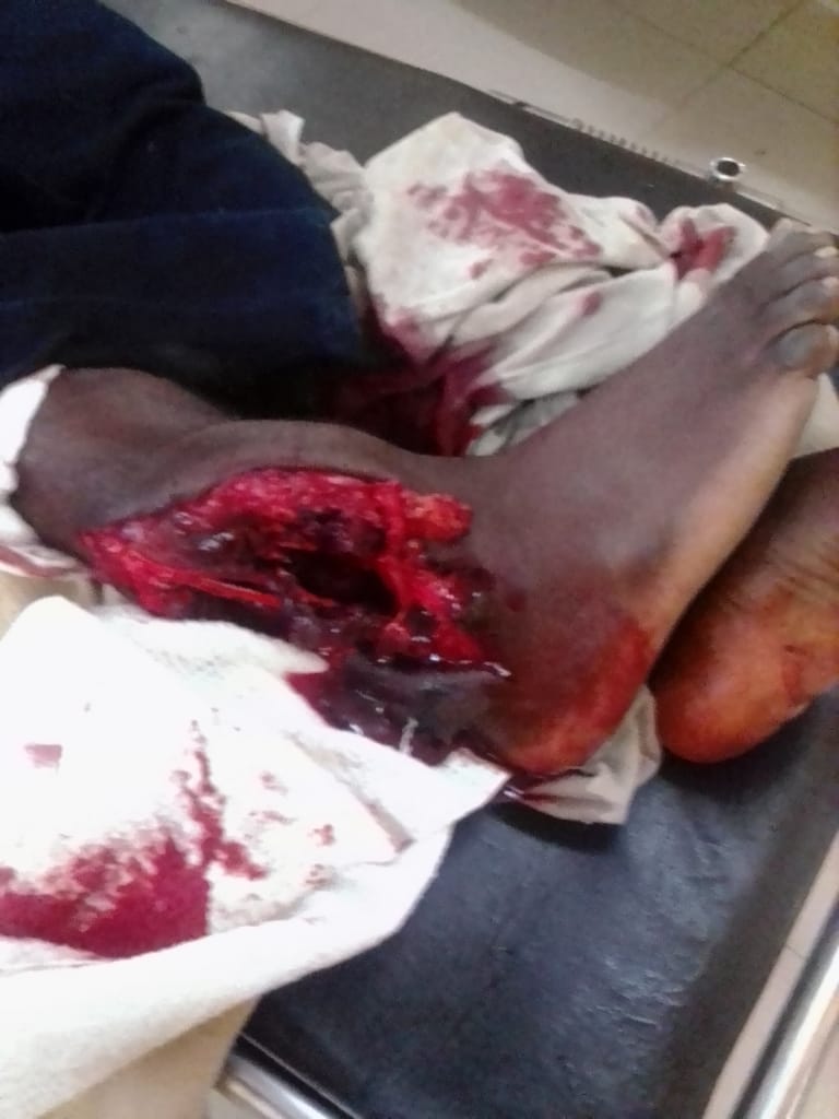 PacheduZW's tweet photo. #Graphic

The police have reportedly shot a vendor who was selling  groceries at Unit L shopping center in Chitungwiza

#JULY31 @PoliceZimbabwe https://t.co/w7DhzcKbCa