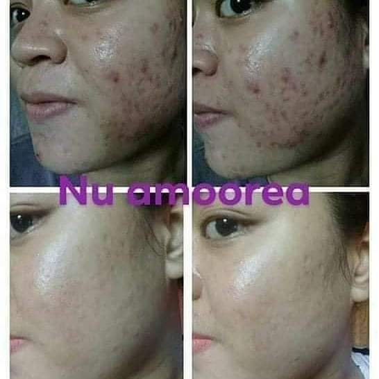 Muwiyahgmailco1's tweet photo. Yg mau pindah ke sabun kesehatan moggo mumpung ada promo https://t.co/XOrd2YaiFd
