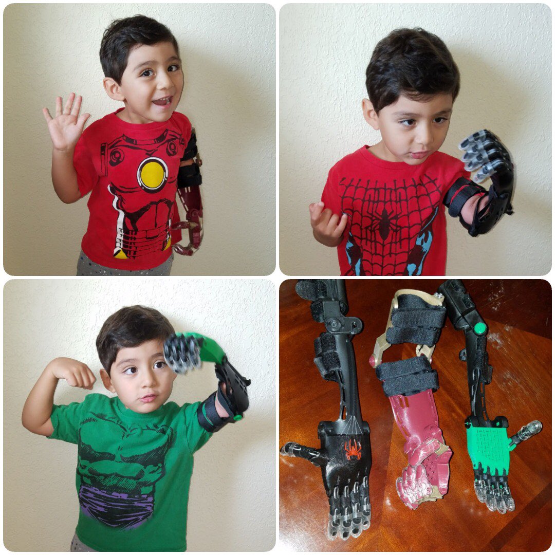 ValeriePerez👩🏻🏫 (@valperez_steam) on Twitter photo With all the uncertainty surrounding the upcoming school yr, I am certain we will keep our #LendAHelpingHandSTEAMProject thriving. Meet Roberto, our 3yr old recipient of our <a href="/Enablethefuture/">Enabling The Future</a> #3dprint prosthetic 🦾 ! His dad says he ❤️ superheroes, but Roberto is the true hero! With all the uncertainty surrounding the upcoming school yr, I am certain we will keep our #LendAHelpingHandSTEAMProject thriving. Meet Roberto, our 3yr old recipient of our <a href="/Enablethefuture/">Enabling The Future</a> #3dprint prosthetic 🦾 ! His dad says he ❤️ superheroes, but Roberto is the true hero!