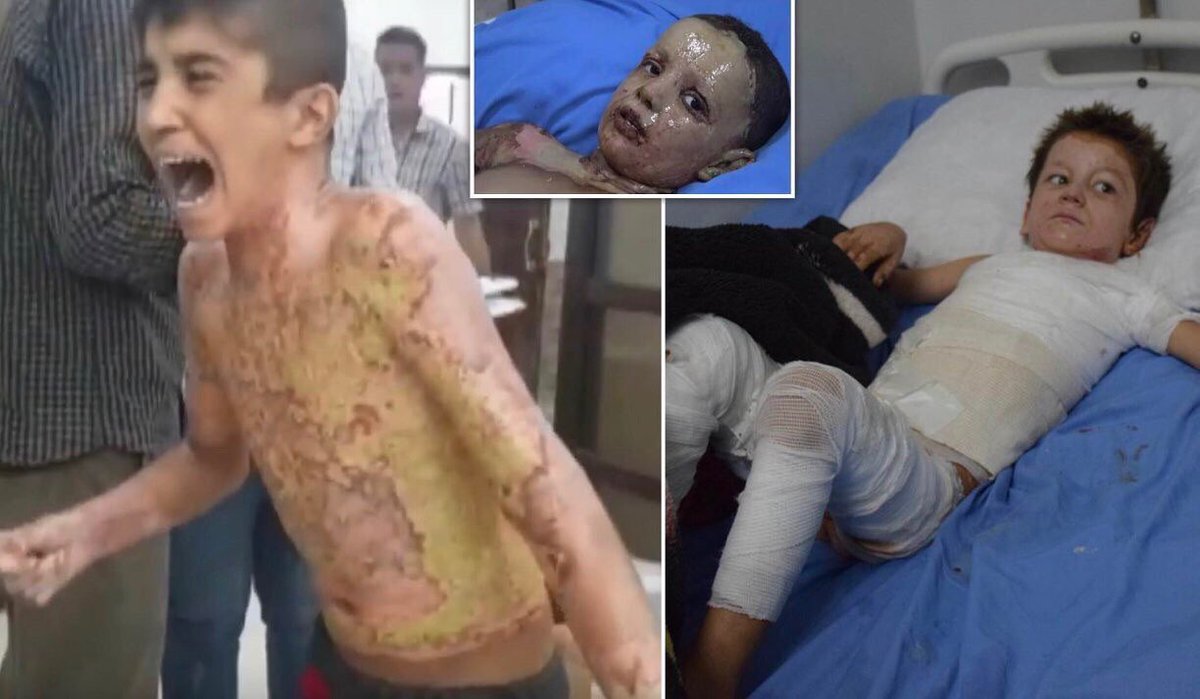 NoSoyBonito__'s tweet photo. ¿Cuántos civiles tienen que morir para que Erdogan sea considerado un criminal de guerra? #Justice4Kurds https://t.co/Ldz8hdqMiv