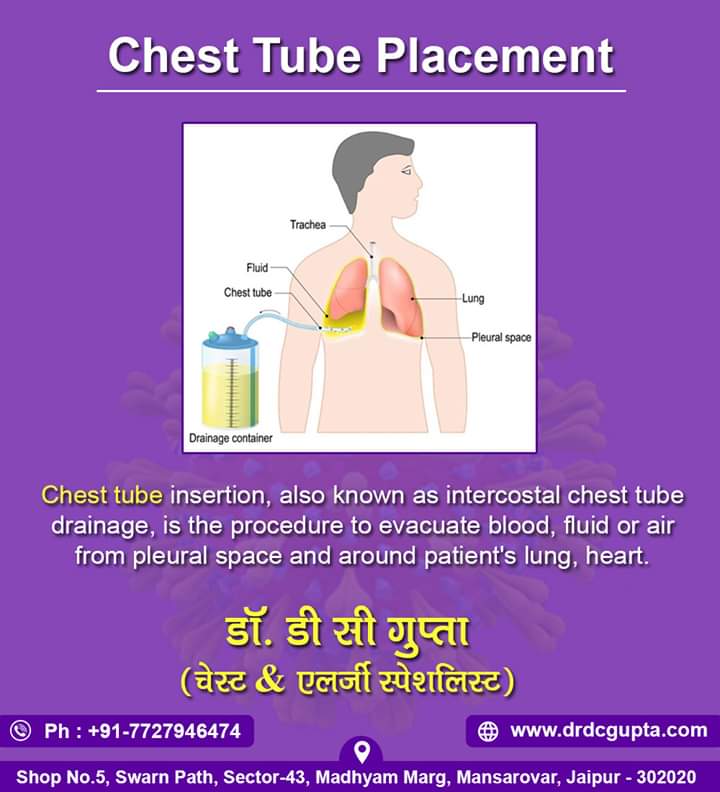 Chest Tube Placement Intercostal Space