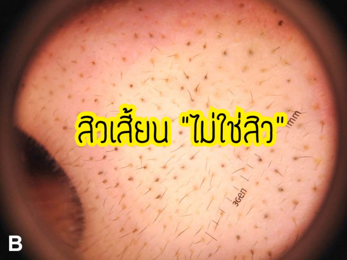 เมียหมอขอรีวิว🤍 tweet media