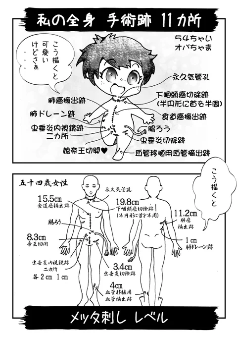 手術後 最初のイラストは、自虐になります。
どれだけ痛いか、ご想像くださいマセ。

自分で言うのも何だけど、
私は よく頑張って 生きてますよ。 