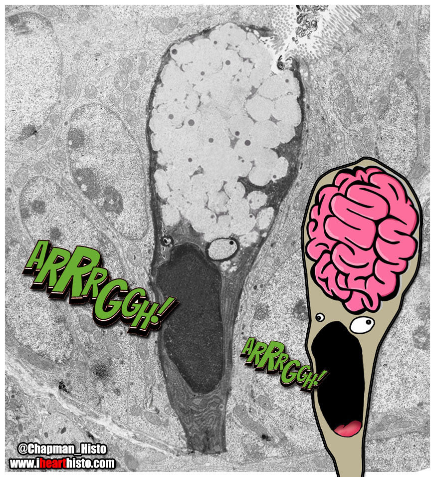 Chapman_Histo's tweet photo. Throwback: The proud moment when one of your electron micrographs gets IHeartHisto'ified....
#ZombieGobletCell #Histology #Alimentary https://t.co/k1xV8oPKws