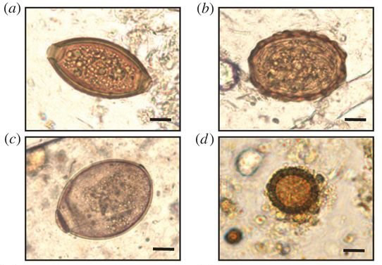 archaeologyEAA's tweet photo. Archaeoparasitologist @pgflammer finds genetic type of parasitic worm from a posh medieval #Bristol (Finzel's Reach) latrine found in one other place in Europe - the Baltic port of #Lübeck. @UniofOxford @oatweet https://t.co/wMNQfKNSwT Published paper at https://t.co/FHlqfWbWmG https://t.co/rrZ318K0KW