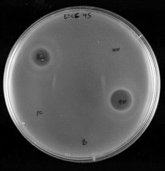 UA_Universidad's tweet photo. Crean un antibacteriano frente a la bacteria E.coli. 
Supone una alternativa a los antibióticos y parte de Microbiología Molecular UA (Francis Mojica).
La E.coli es causante de patologías infecciosas como la diarrea del viajero, diarrea hemorrágica... https://t.co/gqMbhdQGrg https://t.co/JPq3DVsgEy
