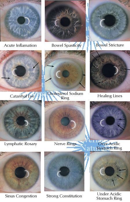 Today's Lesson: Iridology Charts.