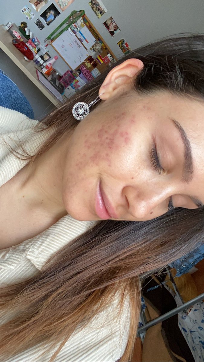 rotkäppchen 🇵🇸 tweet media