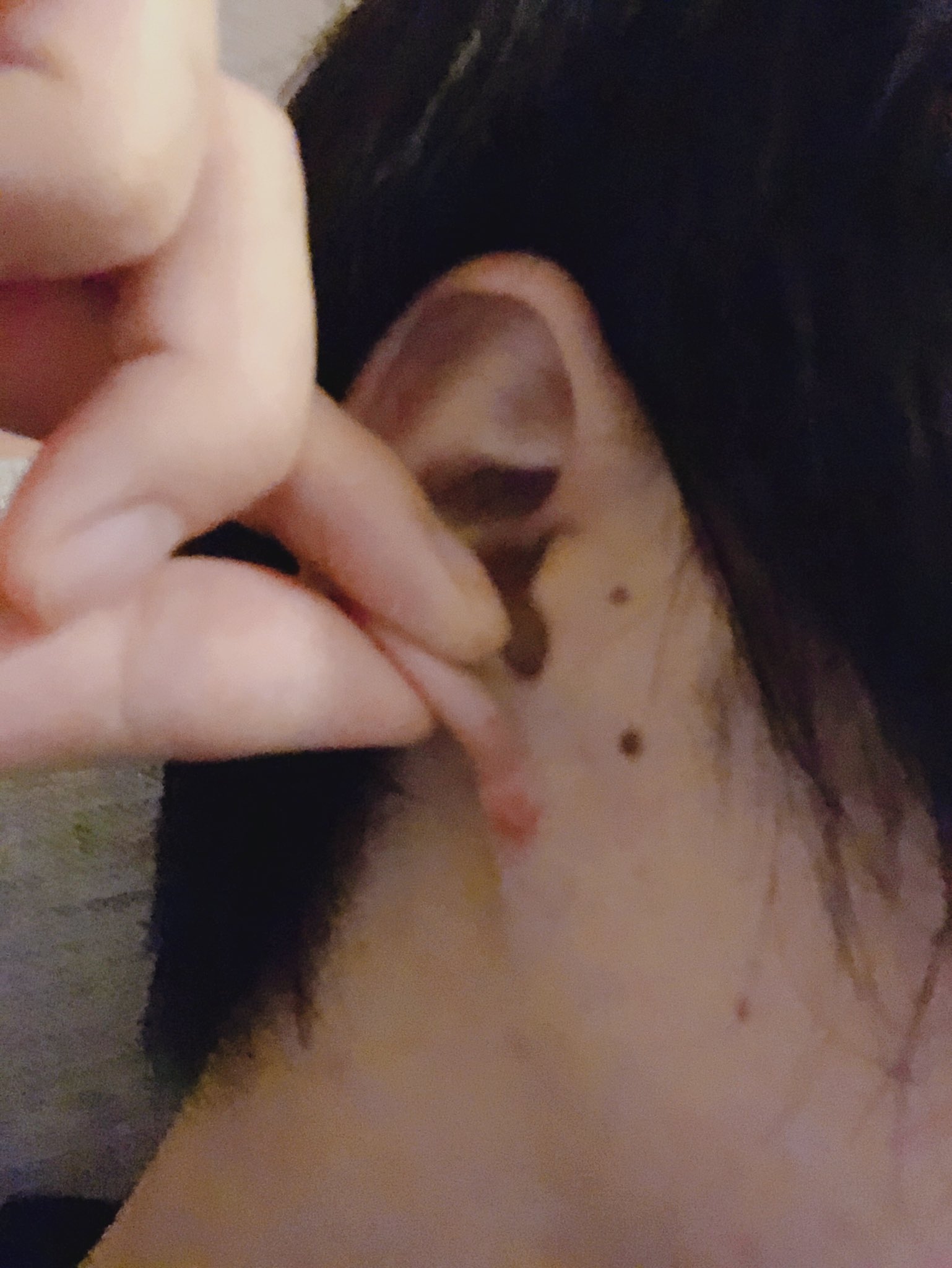 佐藤 祐吾 なんか すごいところ蚊に刺されました どうせ刺すならもっと血が美味しそうなとこにすればいいのに T Co Fxfkary4dk Twitter
