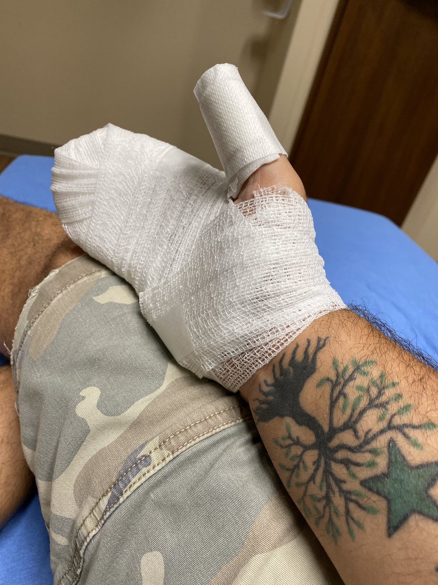 justingomez's tweet photo. Not fireworks related. #burn https://t.co/lrltNLFB84