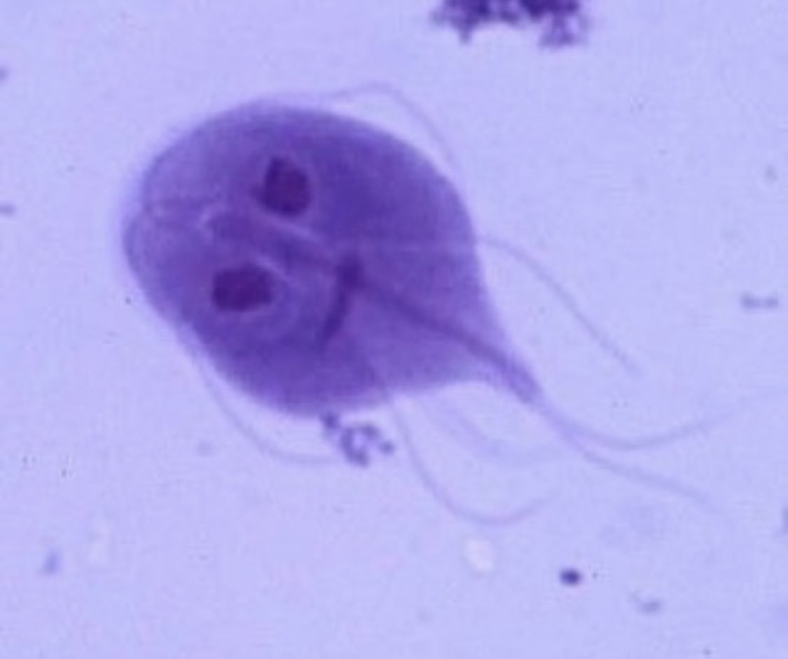 Lamblia paraziti nedir, Giardioza, črvi, ki živijo v človeku - Lamblia paraziti nedir