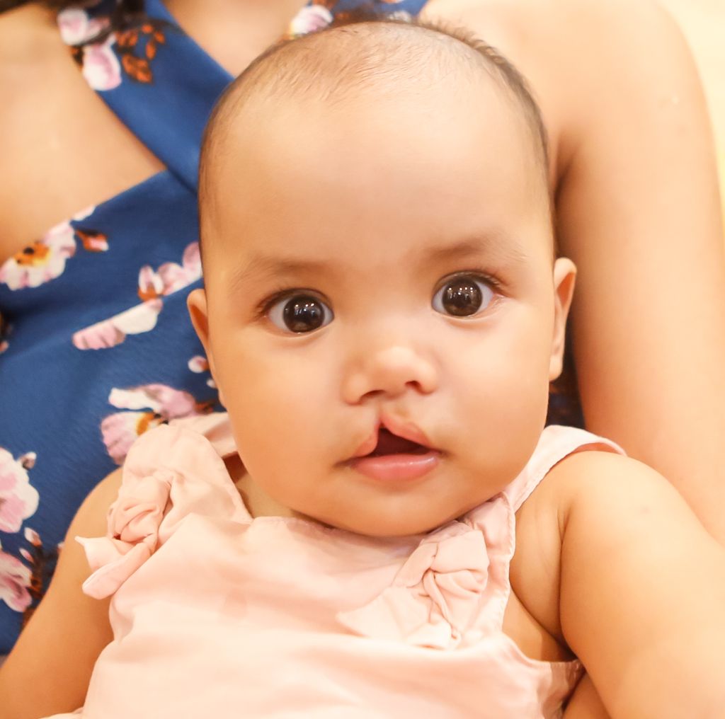 smiletrainuk's tweet photo. July is #CleftAwarenessMonth and we have some brilliant news! 😊

We are proud to announce that we have begun resuming life-saving procedures in more than 50 countries, where surgeries had been previously paused due to the current pandemic! https://t.co/5QF6T0jF3N