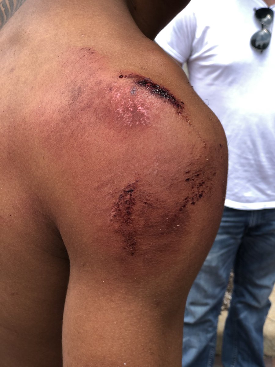 Ohun_Ashe's tweet photo. This is Elijah, a leader in the movement. This is how violently he was arrested for non-violently protesting at @FlorissantPD last night. The fight continues. https://t.co/qTUUollFNM