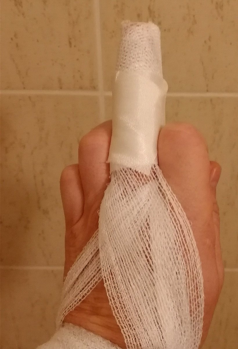 PetrSssss's tweet photo. [den 741]
Tělo už pomalu vypovídá službu.
Během 1 roku:
- popáleniny 1 a 2st 👍(bez 🚑)
- přetrhané vazy, měsíce bolestí, prst už neohnu (bez 🚑)
- týdny zablokovaná krční páteř (bez 🚑)
- 3 měsíce vyhřezlé ploténky, levá noha nefunkční...
Nejvíc mě ale bolí u srdce.... https://t.co/95twR9ngsE