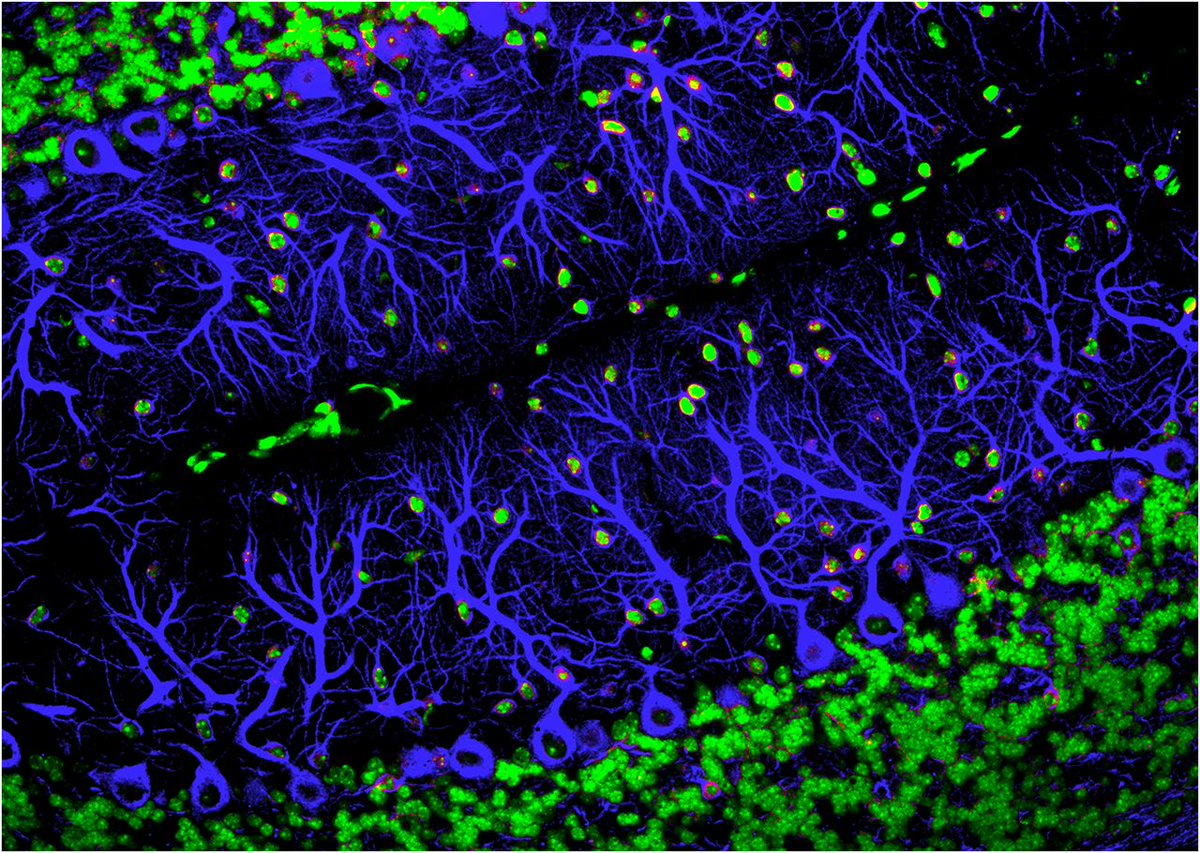 PNASNews's tweet photo. How #synapticpruning shapes neural wiring during development and, possibly, in disease. A PNAS Core Concept: https://t.co/2PNVfPAXf3 #synapse #schizophrenia #Alzheimers https://t.co/pw5UUVZbqH