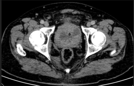 Fernando Ide Yamauchi tweet media