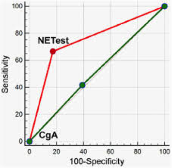 NeuroEndoTalk's tweet photo. Professor Massimo Falconi @SanRaffeleMI and his colleague @spartelli reflect on a novel liquid biopsy #NETest as a promising new blood biomarker for the surgical management of pancreatic #NETs.
https://t.co/MLyjzkVW65
What do you all think? 
#PanNETs
#NeuroEndoTwitter
#MedTwitter https://t.co/Ewd33S6bPX