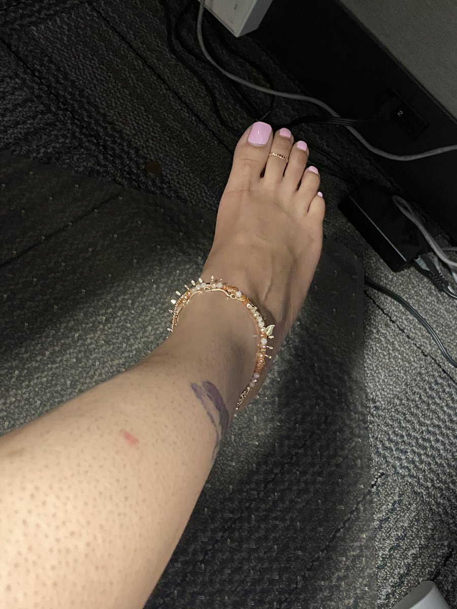 DRoseToes1's tweet photo. Work feet! Who wants to rub them for me??

#expore #footlovers #feet #pedicures #wokflow https://t.co/9w7fJJZM0x
