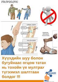 Өглөөний мэнд~ 😇
Тохойн мултрал нь 6-аас доош насны хүүхдүүдэд түгээмэл тохиолддог гэмтлийн нэг юм. Энэ нь энэ насны хүүхдүүдэд шуу ясны толгой хэсэг насанд хүрсэн хүнтэй харьцуулахад гүйцэд хөгжөөгүй байдгаас амархан мултрах хандлагатай байдаг.